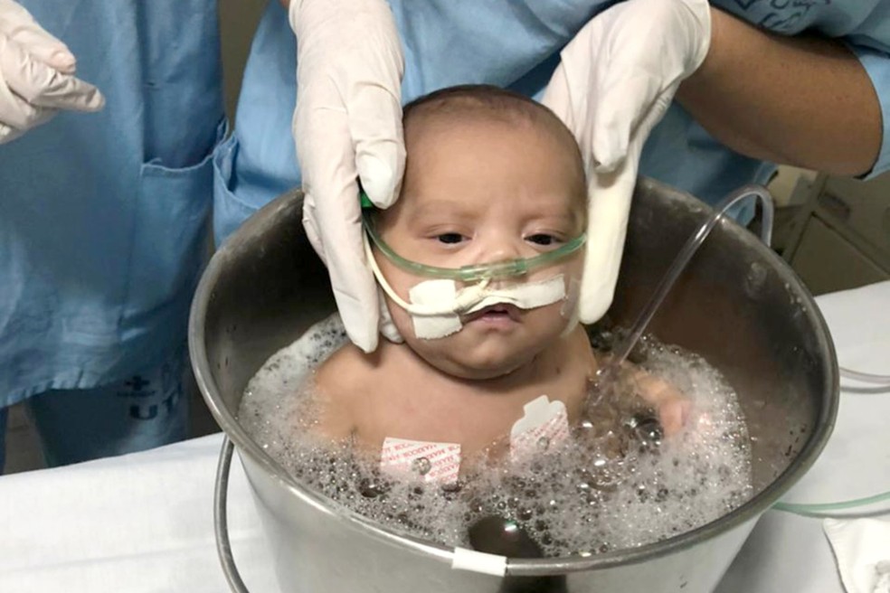 Hospitais utilizam banho de ofurô em bebês. Foto: Iges-DF/Divulgação